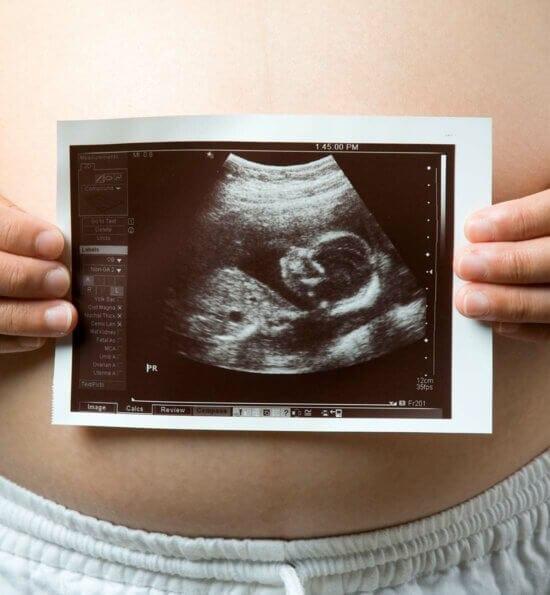 Pregnancy Weeks 12-16: First Glimpse of our Baby